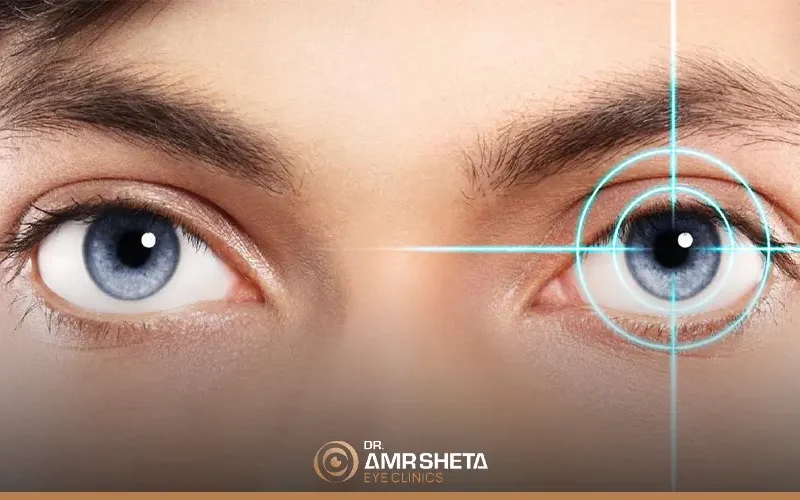 هل الاستجماتيزم خطير؟
